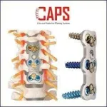 cervical-anterior-plating-system_10.webp